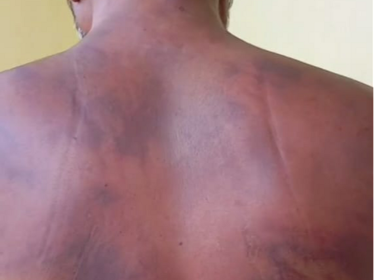 You are currently viewing शहपुरा पुलिस पर युवक की कस्टडी में बेरहमी से पिटाई का आरोप, हालत बिगड़ी तो जेल से छोड़ा – CM से जांच की मांग