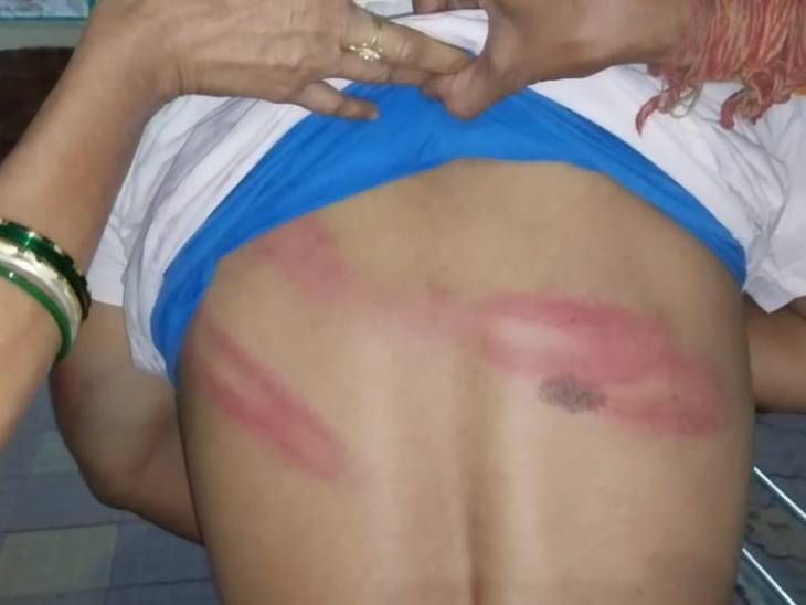 You are currently viewing जबलपुर में भाजयुमो नेता की थाने में बेरहमी से पिटाई: पुलिस पर लगाए गंभीर आरोप, बोले- आधे घंटे जानवरों की तरह पीटा; पुलिस बोली- झूठे दावे!