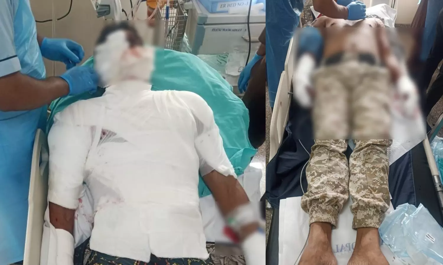 You are currently viewing भोपाल की 25वीं बटालियन में मॉक ड्रिल के दौरान बड़ा हादसा: ग्रेनेड ब्लास्ट में दो जवान गंभीर रूप से घायल, एक की हालत नाजुक!