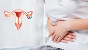 Read more about the article बढ़ता वजन हो सकता है पॉलीसिस्टिक ओवरी सिंड्रोम (PCOS) का संकेत, जानें लक्षण और फूड टिप्स